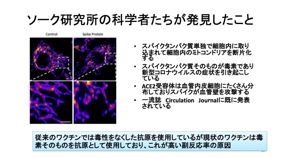 ワクチンの中身は毒素 接種済みの人が感染で重症化 Forbes記事に専門家から批判 訂正重なり 慎重さの欠如反省