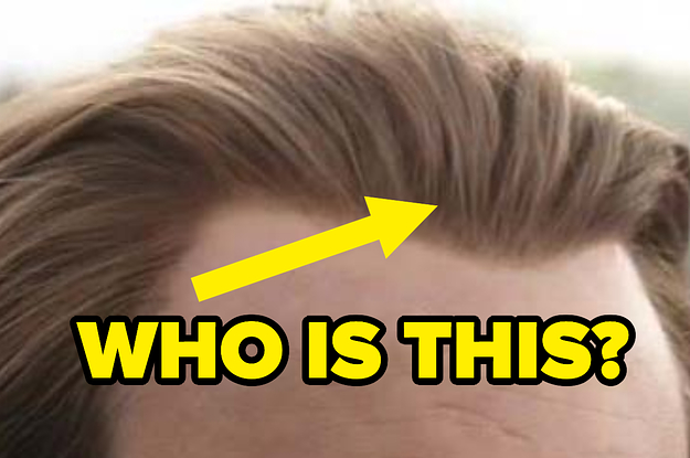 A hairline with slicked back blonde hair