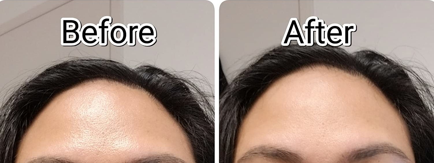 35 Beauty rs Before And After