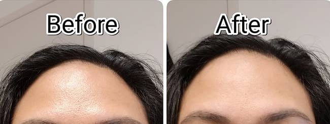 reviewer's oily forehead before using the face roller compared to it looking much more matte after using it