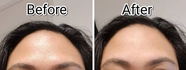 reviewer's oily forehead before using the face roller compared to it looking much more matte after using it