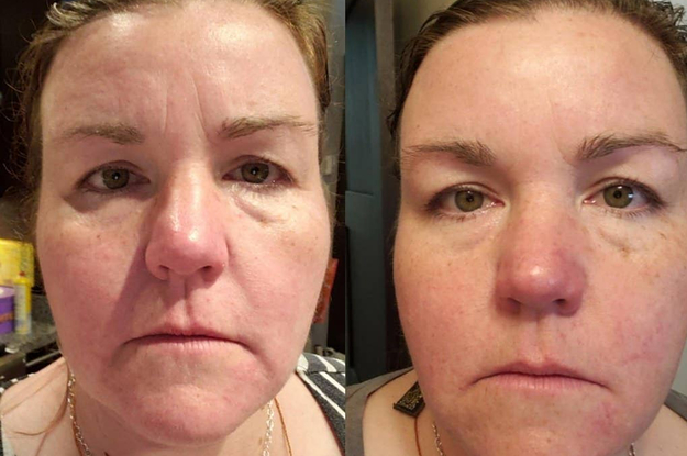 Side by side comparison of a reviewer with noticeable forehead lines and under eye bags before using a snail serum and the same reviewer with brighter under eyes and tighter forehead skin after using the serum consistently