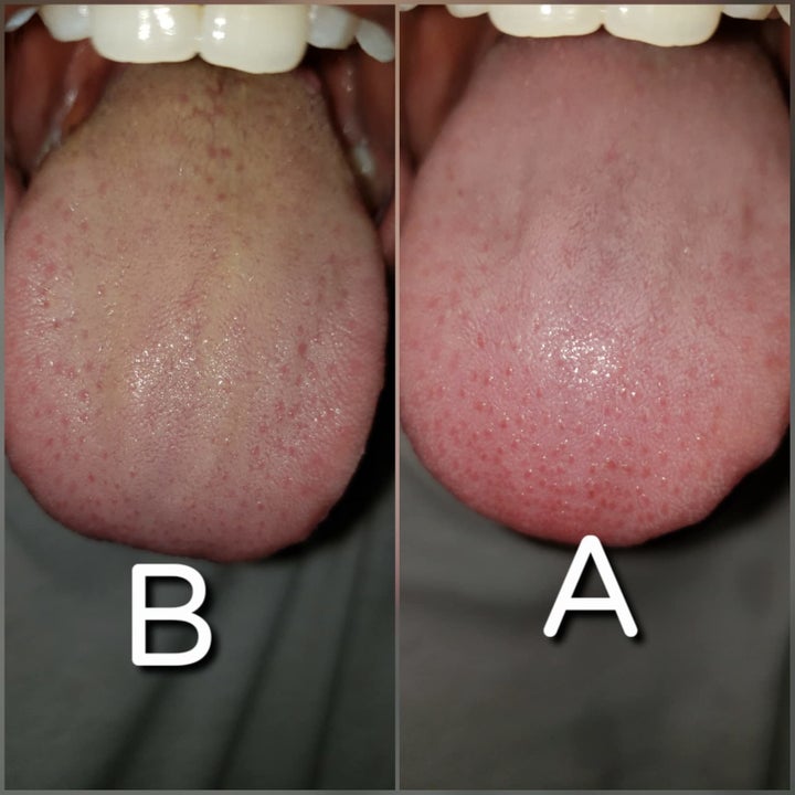 reviewer's tongue yellowish then clean