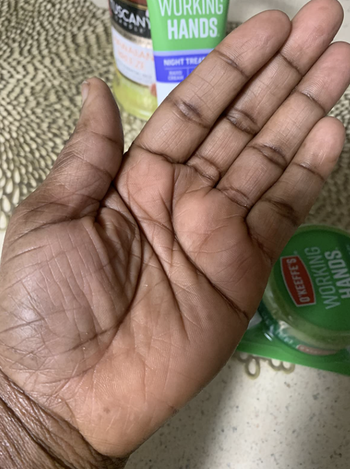 the same reviewer's hand after using the product, now smooth with no visible dryness 