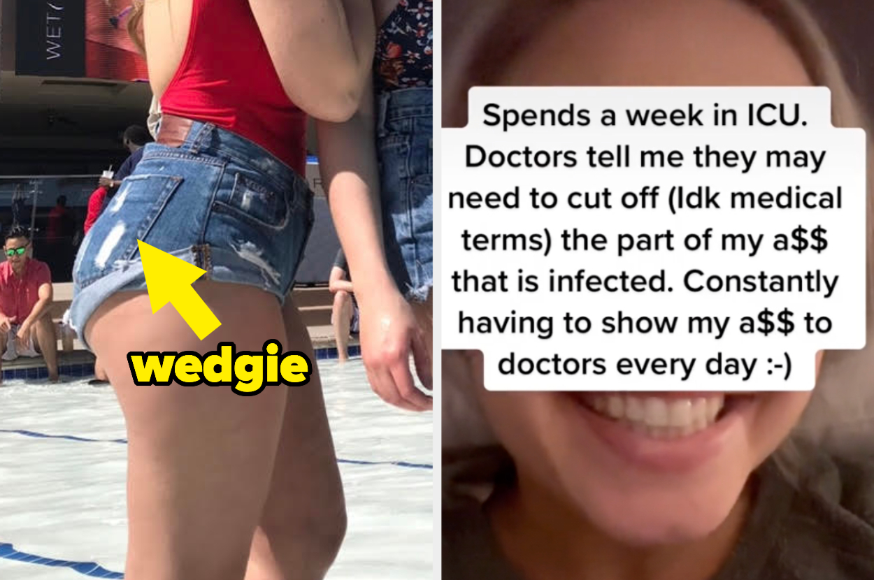 Woman reveals wedgie from too-tight jean shorts caused her to be