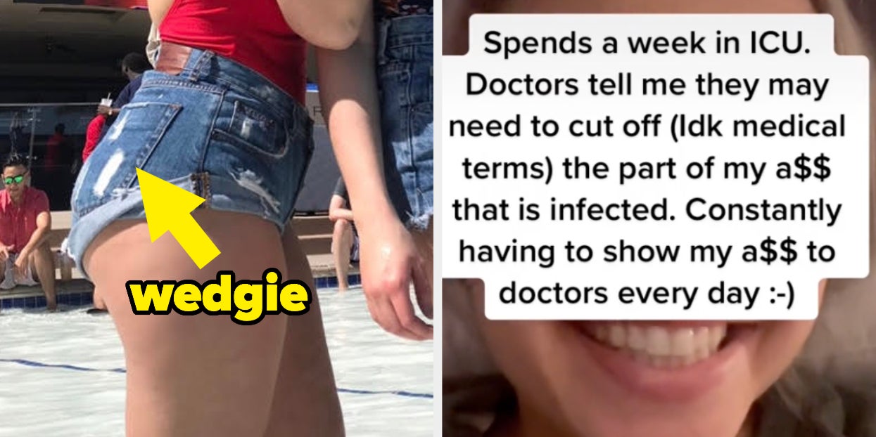 This Woman Had A Wedgie That Sent Her To The Hospital And Let This
