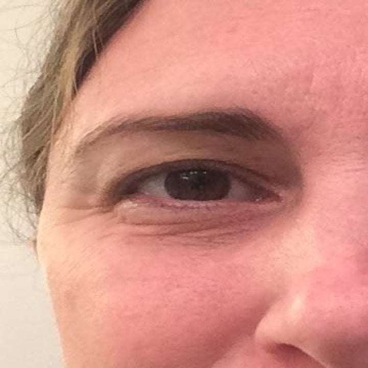 reviewer with dark under eye circles and noticeable lines around their eyes