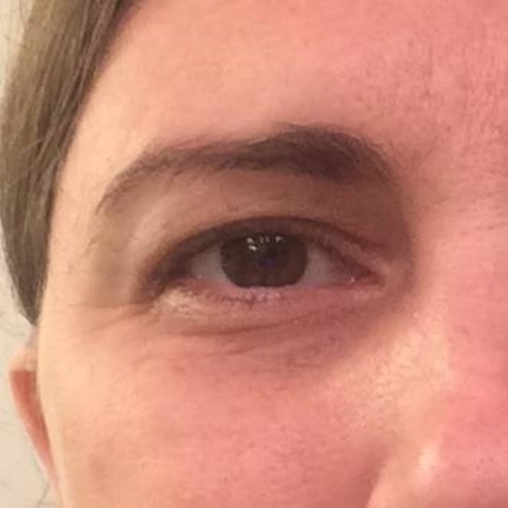 the same reviewer after using the serum showing the fine lines have filled in and the under eye area looks brighter