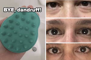 scalp massager and eye cream 