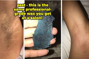 waxed armpit before and after