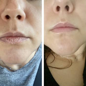 before and after image of chapped lips and hydrated lips