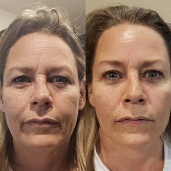Reviewer before and after showing the mask made their skin look tighter and reduced the appearance of some wrinkles