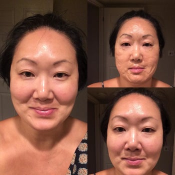 reviewer's before and after pic of skin while wearing the face mask