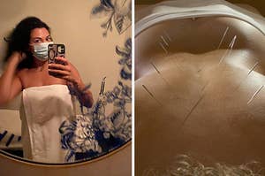 an image of the author getting ready for acupuncture next to acupuncture needles in a back