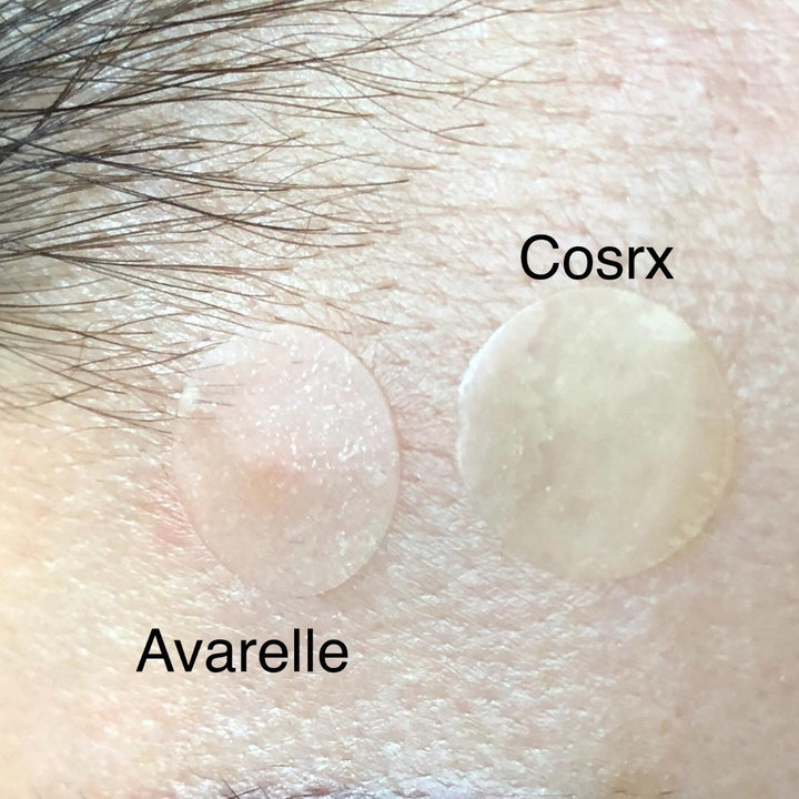 avarelle and cosrx patches on a reviewer's face, the avarelle patch is more transparent