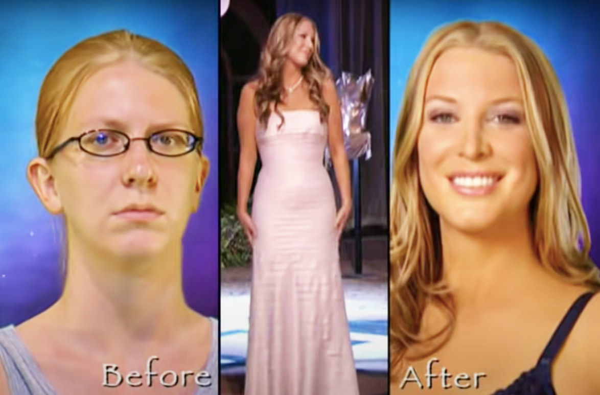 See Biggest Loser And The Swan Stars Now -- Years After TV Makeovers!