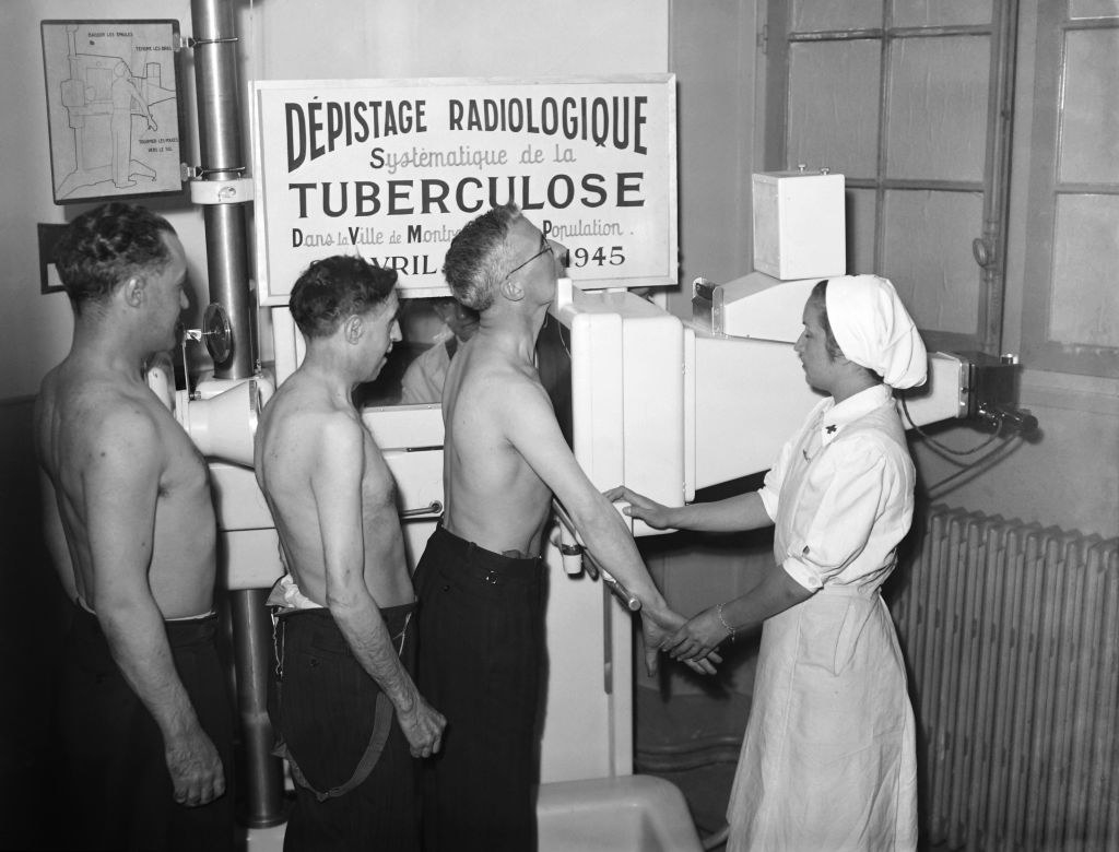soldiers getting tuberculosis chest x-rays