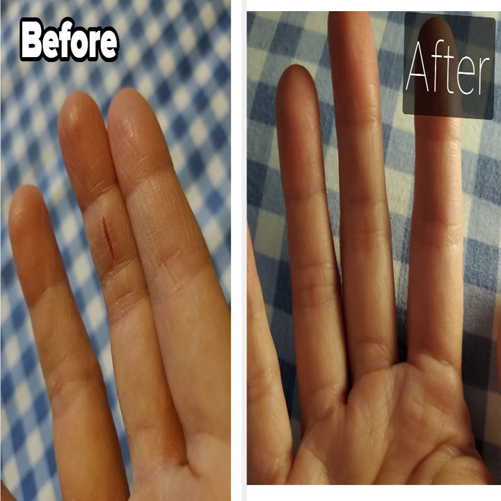 Reviewer photo of a before and after of hands using Gold Bond Ultimate Intensive Healing Hand Cream