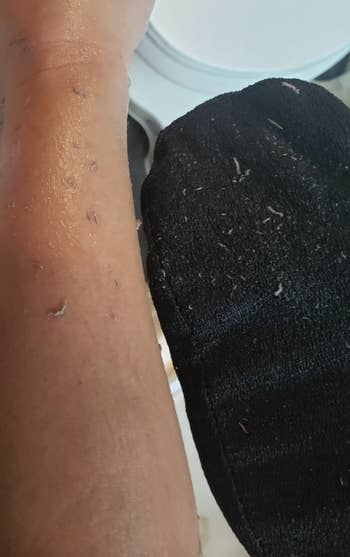 A customer review photo of their pilled dead skin on their arm and on the mitt