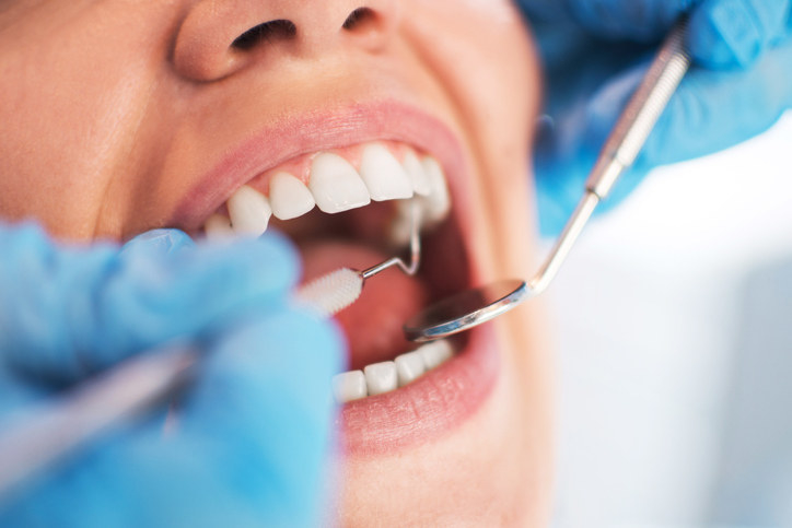 A person getting their teeth checked by a dentist