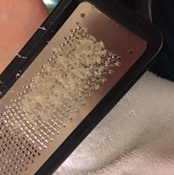 Dead skin left on the foot file after using it