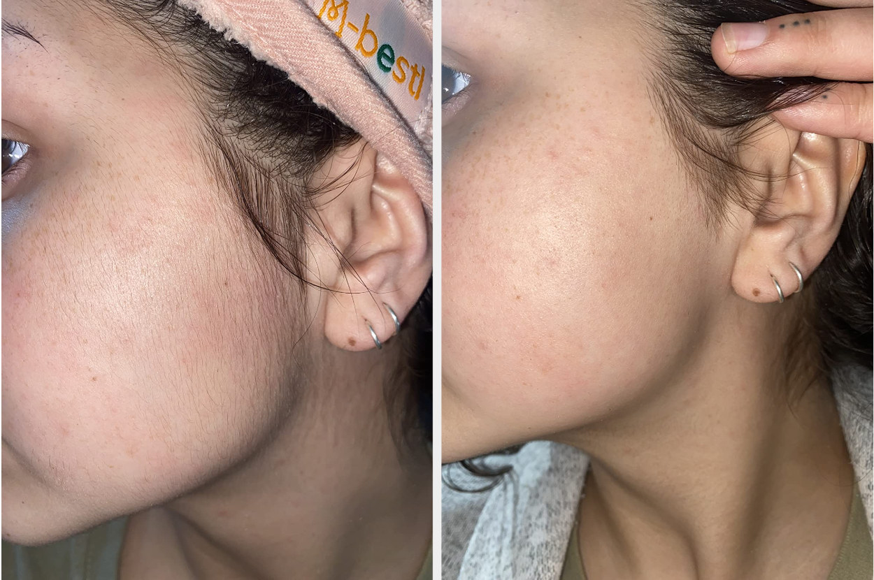 A before and after of a reviewer who used the dermaplaning tool on their face - the left side has fine hairs, while the right side is free of fine hairs and looks visibly softer