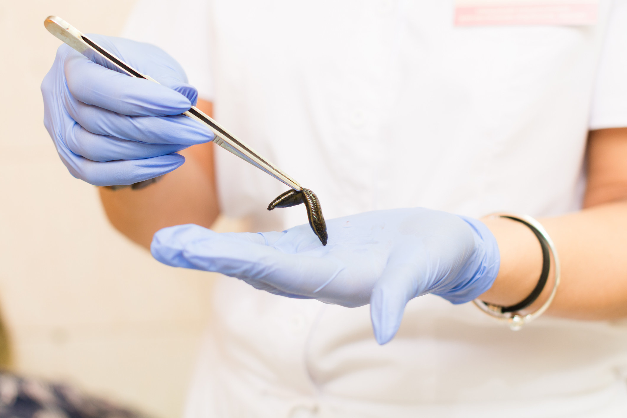 Gloved person picking up a leech with long tweezers