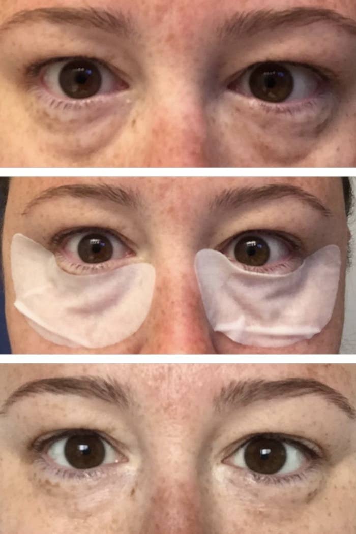 reviewer showing their eyes before, during, and after using the under-eye collage strips