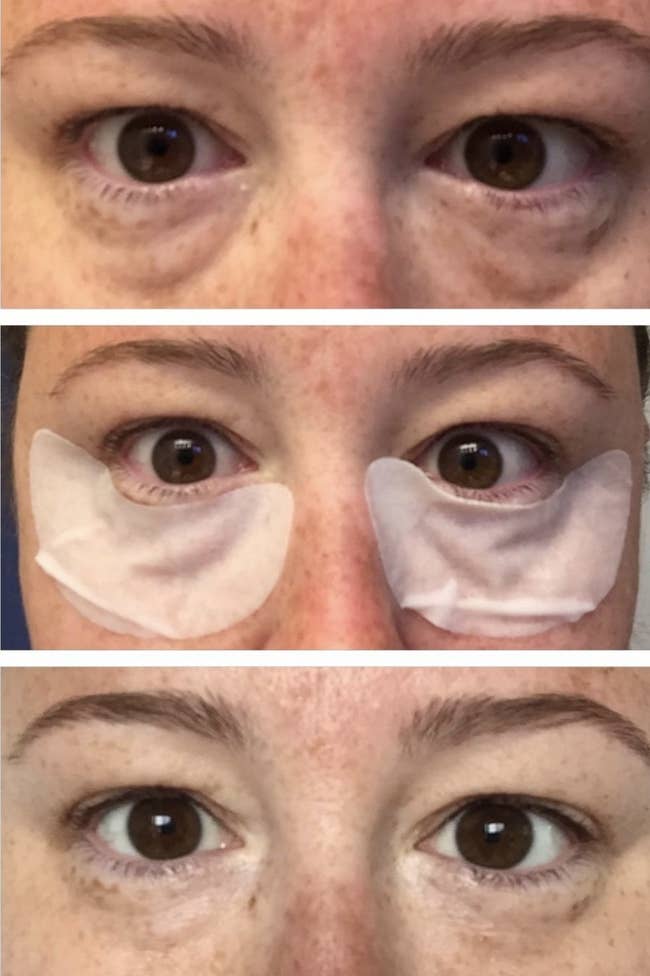 reviewer showing their eyes before, during, and after using the under-eye collage strips