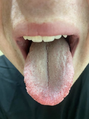 reviewer's tongue clean