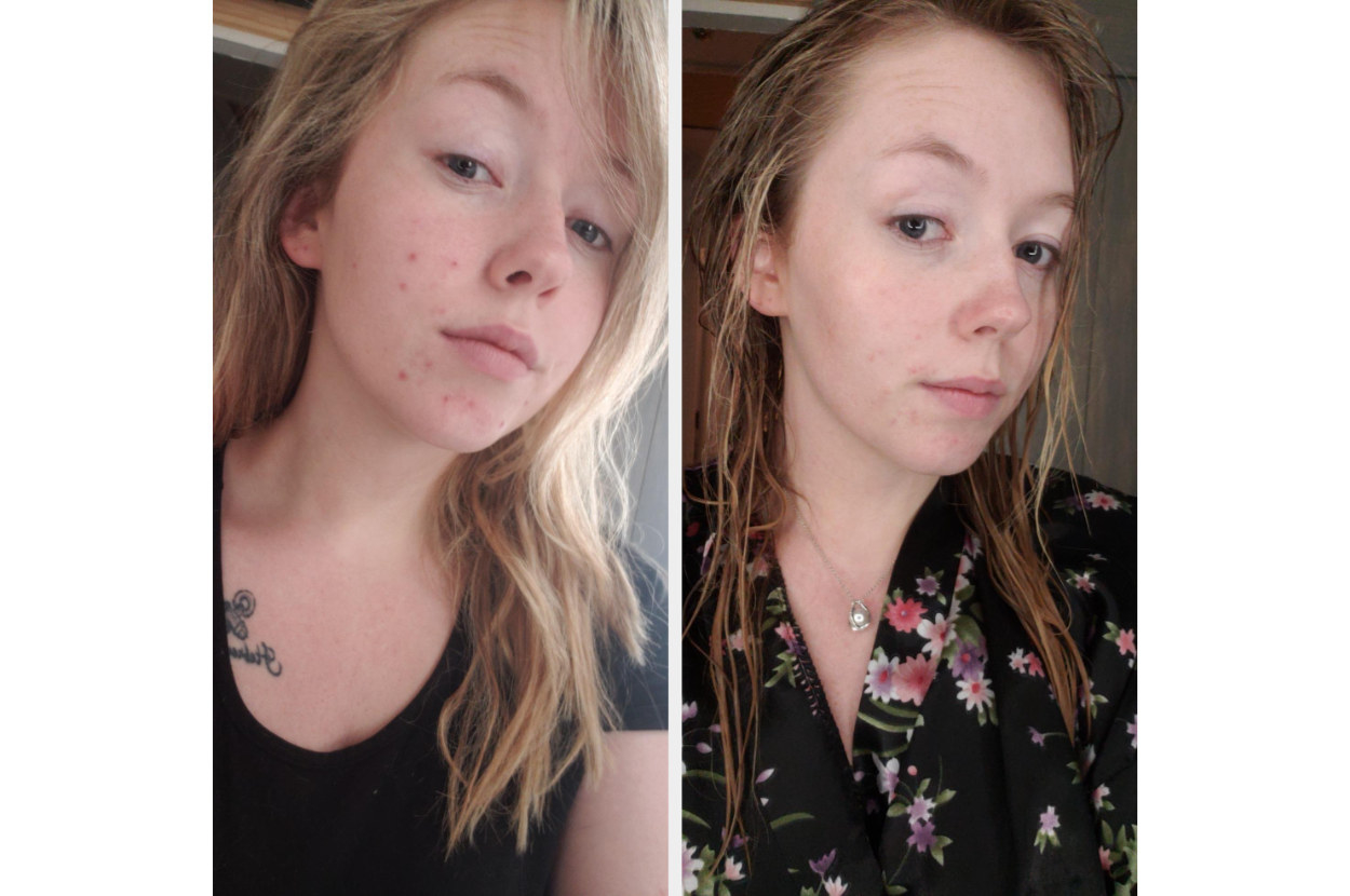 A reviewer's before and after over one week of using the Neutrogena gel cream. On the left, their skin looks dull with some red spots, and on the right, their skin is smooth, brightened, and almost dewy-looking