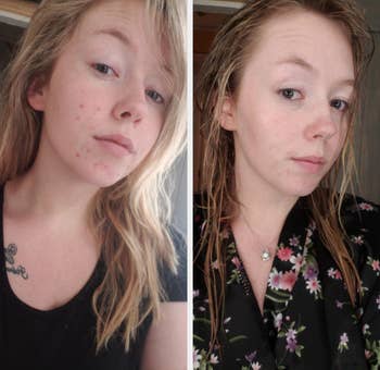 A reviewer's before and after over one week of using the Neutrogena gel cream. On the left, their skin looks dull with some red spots, and on the right, their skin is smooth, brightened, and almost dewy-looking