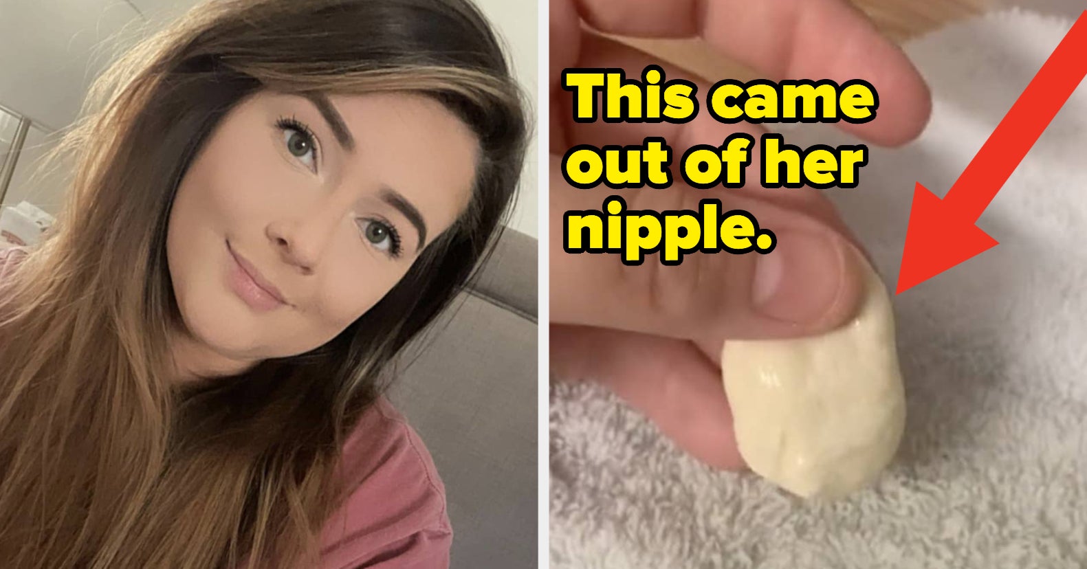 Don't Freak Out About That Viral 'Milk Duct' Image, It's Not