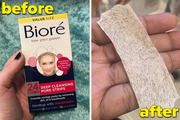 If You’re A Squeamish Person, Then You Probably Shouldn’t Look At The Before-And-After Photos For These 21 Products - BuzzFeed