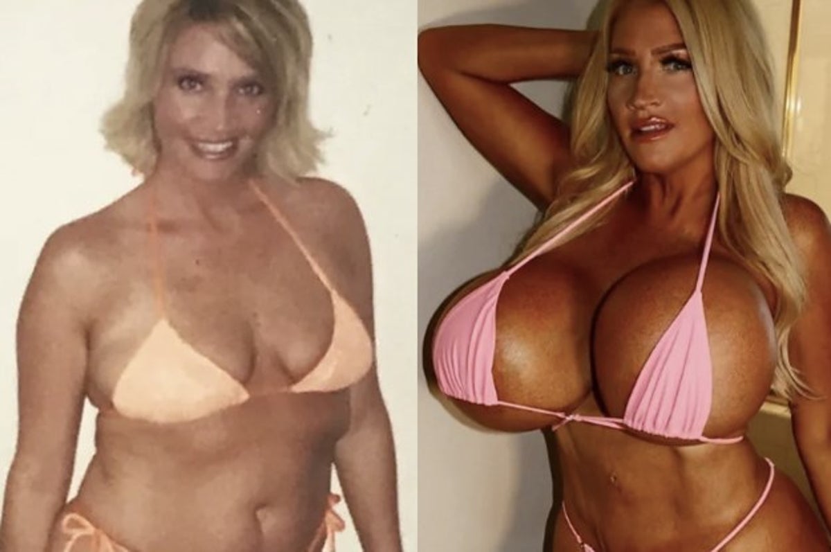 Woman with same bra size since 8 years old crowdfunds boob job