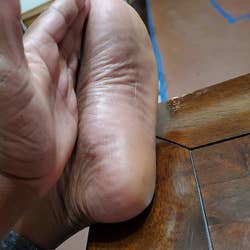 Reviewer's smooth foot after the dead skin peeled away