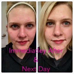 Reviewer photos showing face immediately after using the face mask and next day