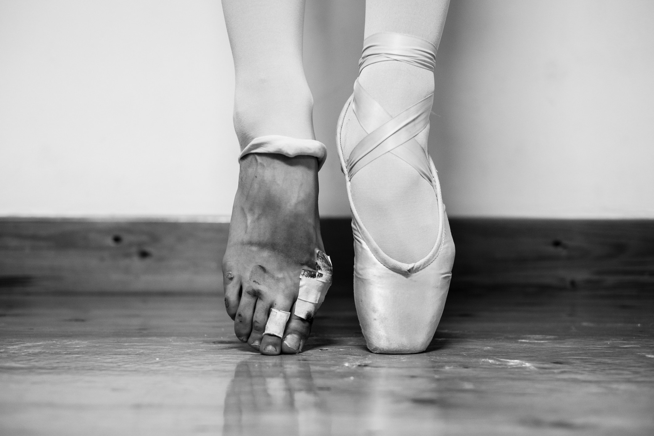 Ballerina stood with one pointe shoe on and one bare foot showing it wrapped up due to blisters.