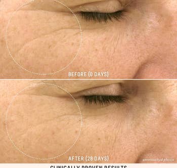 a before and after of a person with fine lines reduced after using the oil