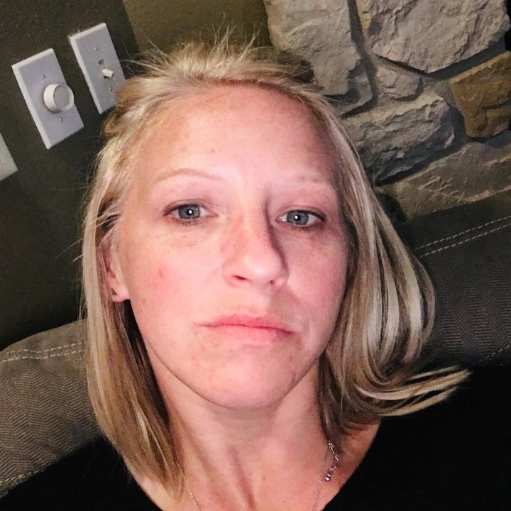 Reviewer before photo showing their red, blotchy skin