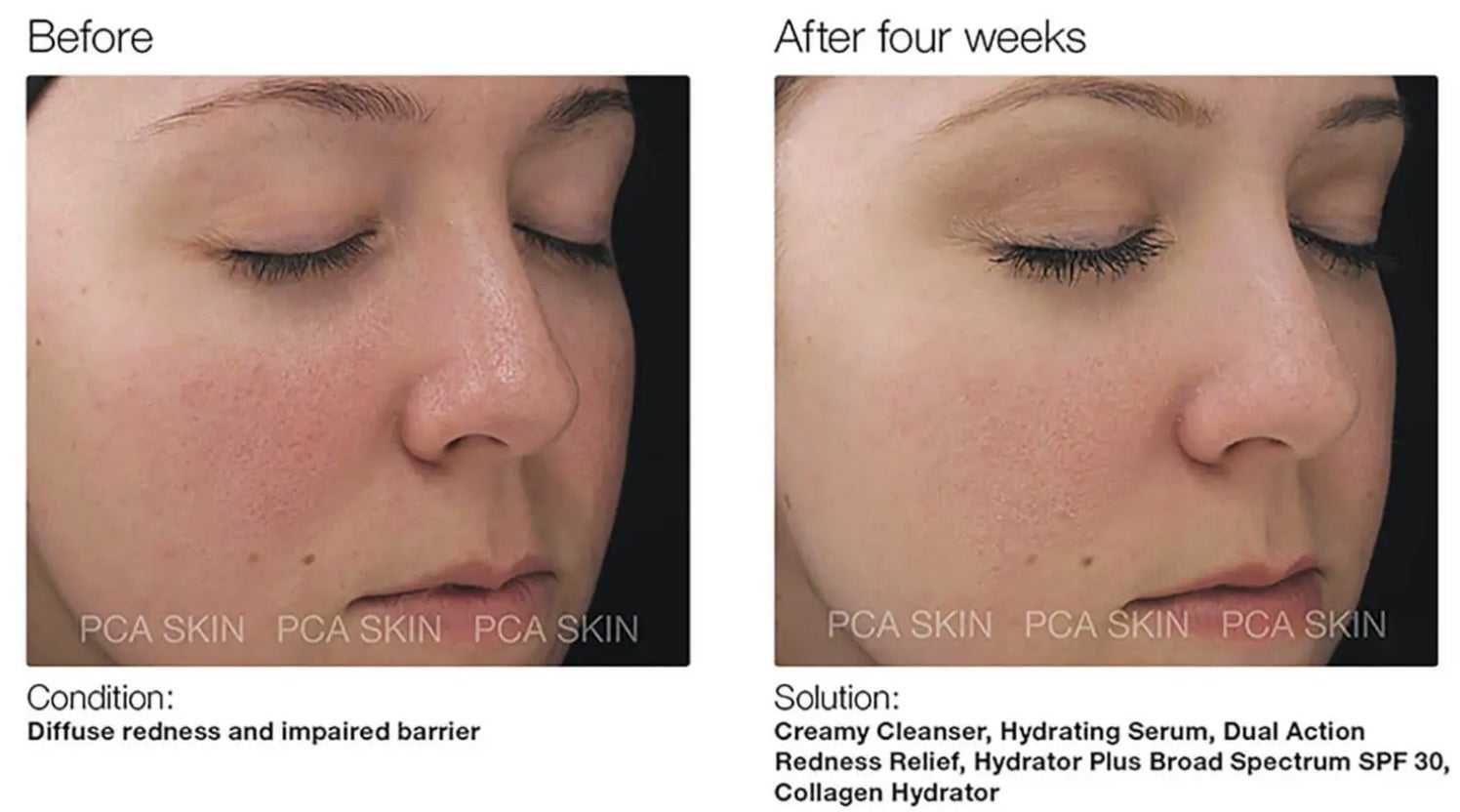 a person with red skin before, and even skin after using this serum for four weeks