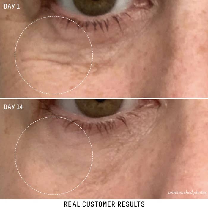 a person&#x27;s eye before and after using this cream for 14 days. there is a visible reduction of fine lines around the eyes