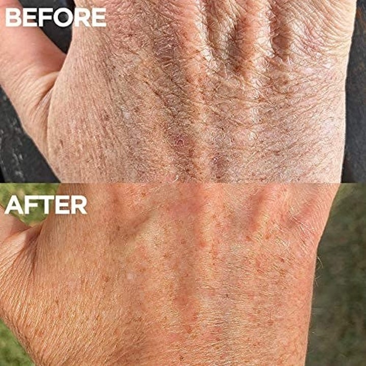 before and after of hand with dry skin and then visibly more moisturized skin