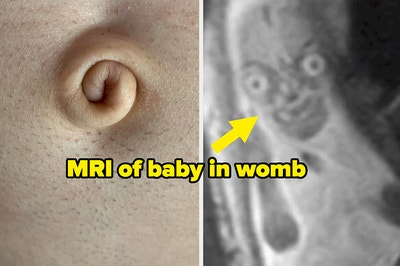 A swirly belly button and a creepy baby in the womb