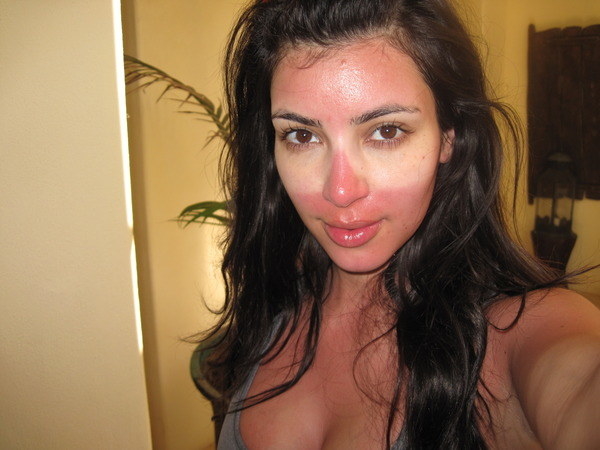Kim&#x27;s sunburned face