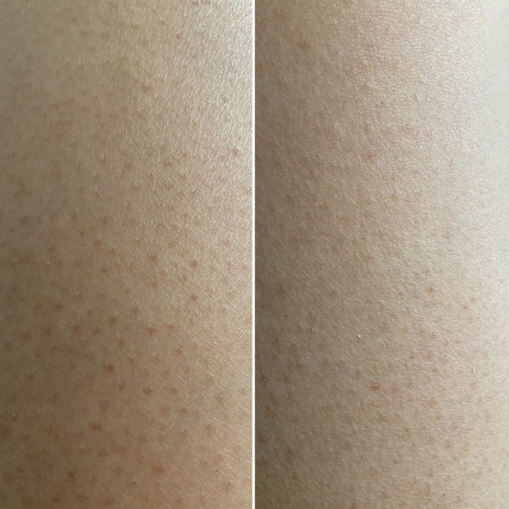 34 Skincare Products That'll Make You Think, "Well Now I Need To Try ...