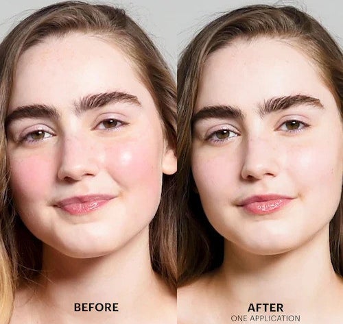 a model before and after using the color correcting treatment with redness on the cheeks greatly reduced
