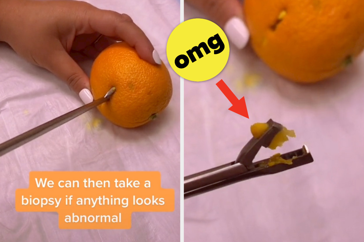 An orange being &quot;biopsied&quot;
