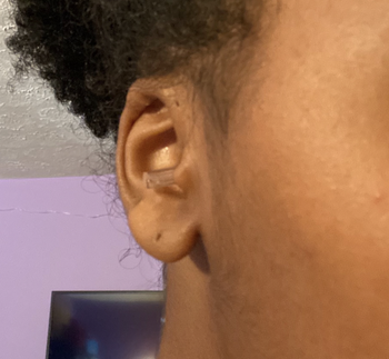 A customer review photo of them wearing the earplugs showing that they're hardly visible