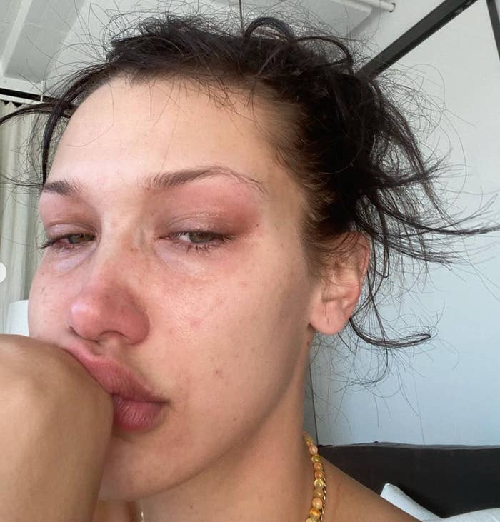 Bella Hadid resting her face on her arm after crying